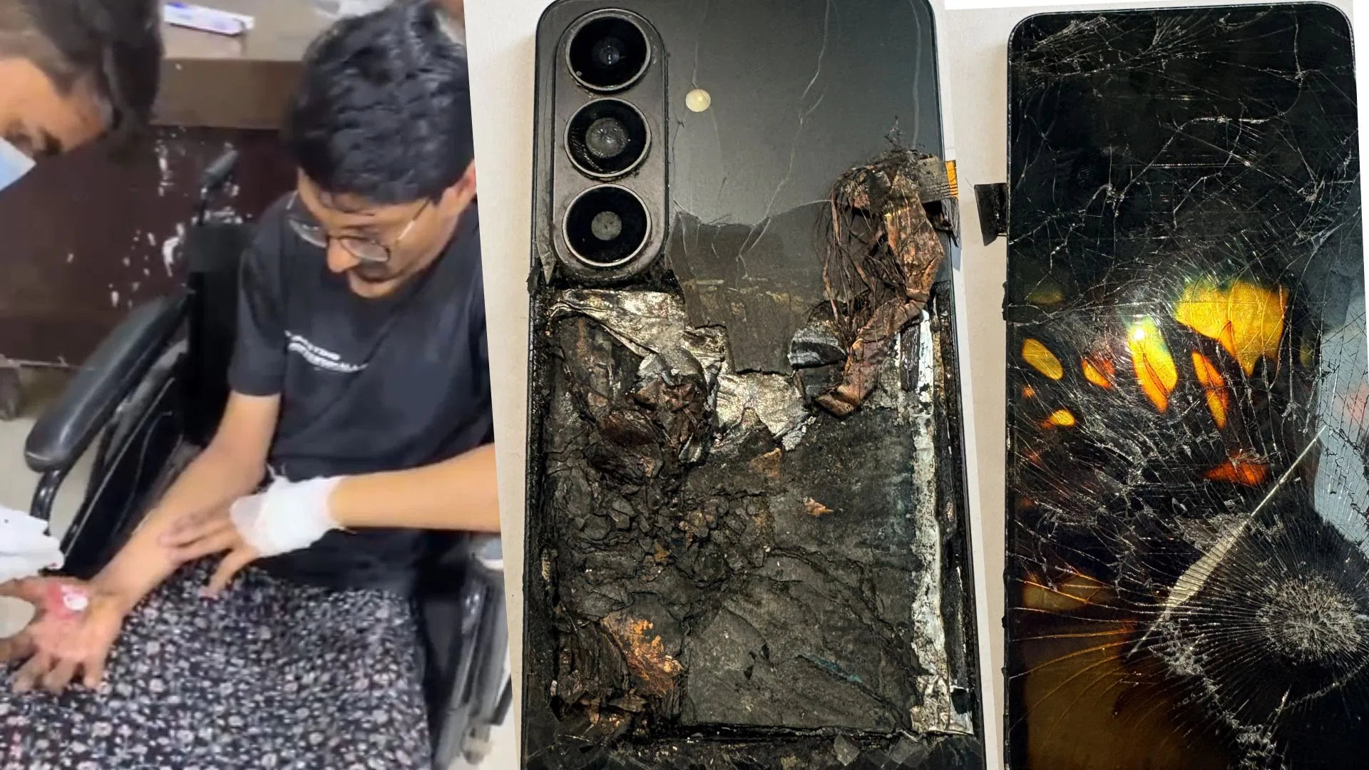 झुलस गया गाजियाबाद रेलवे स्टेशन पर मोबाइल फटने से 26 वर्षीय युवक, गंभीर रूप से प्राइवेट पार्ट्स भी जल गए